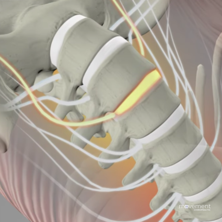 Non-Surgical Spinal Decompression Therapy: Is It Right for You?