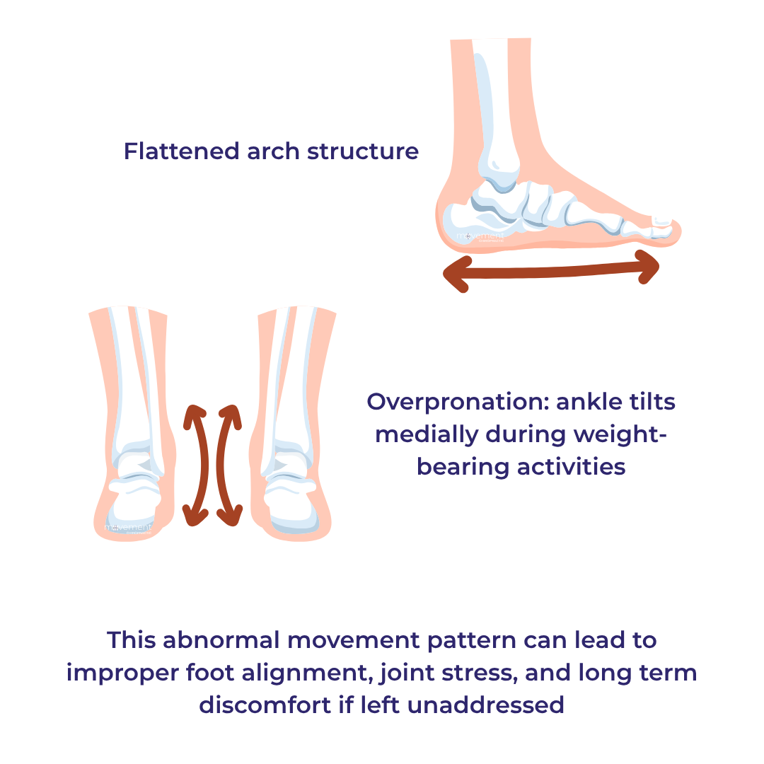 flat feet